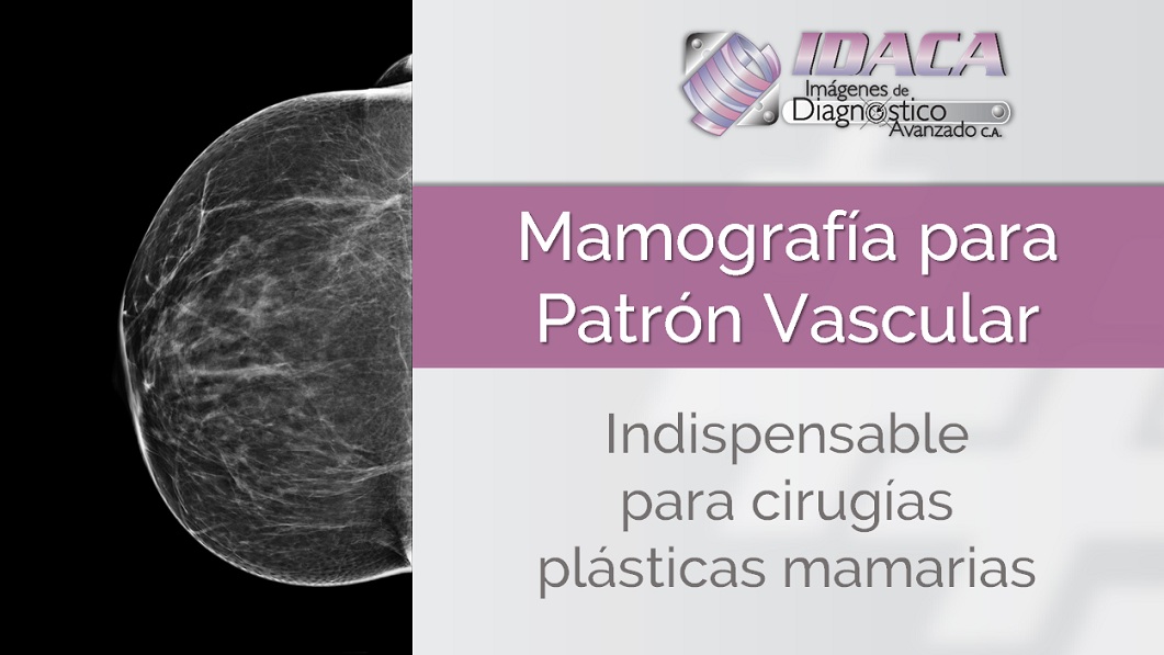 Mamografia patron vascular IDACA CMDLT Tomosintesis